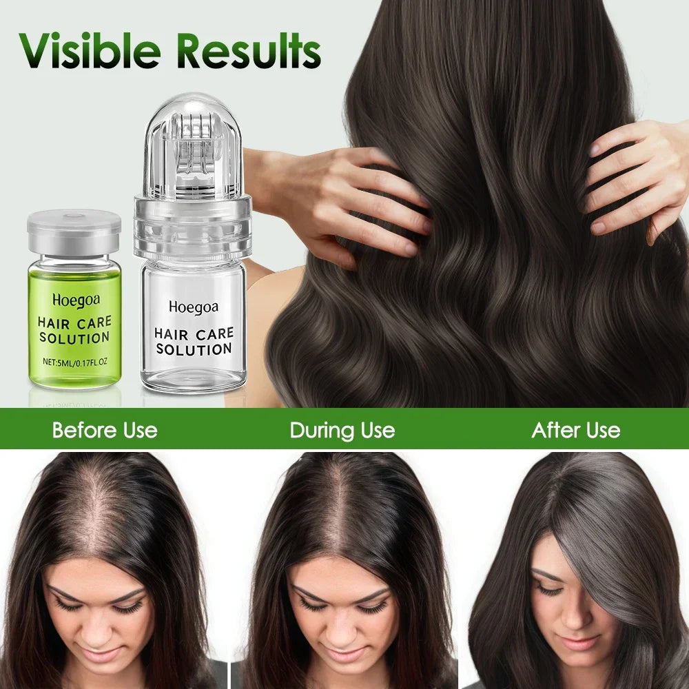 Hair Essential Care Serum for Strengthening Roots, Reducing Hair Loss, Preventing Baldness, and Nourishing the Scalp - Advanced Anti-Hair Loss Conditioner