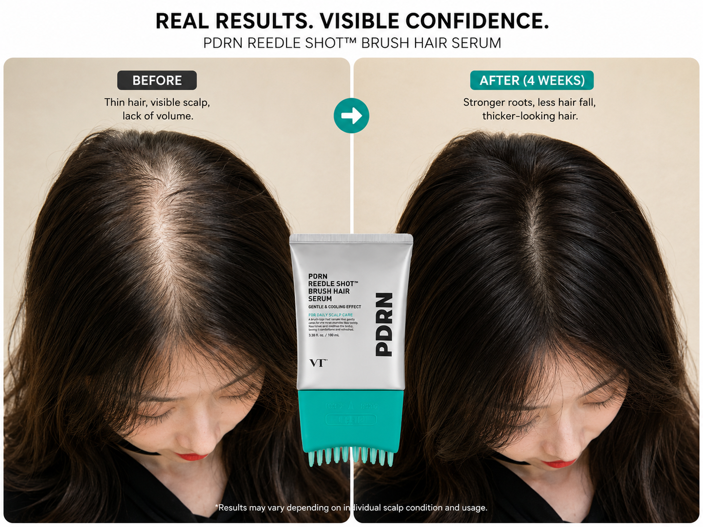 PDRN Advanced Scalp Recovery System