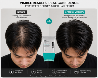 PDRN Advanced Scalp Recovery System